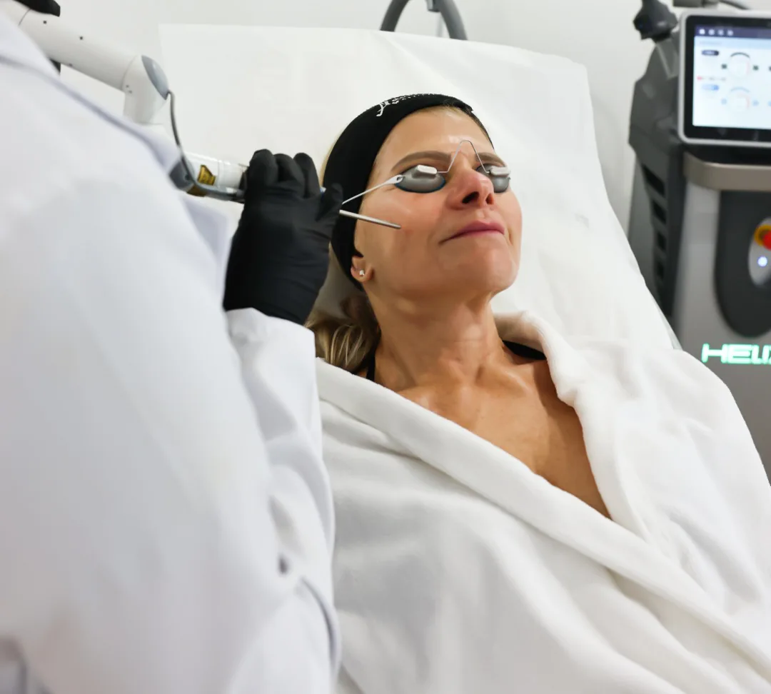 CO2 laser resurfacing facial treatment at Advanced Aesthetics